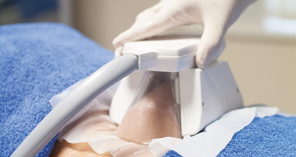 How Fat Freezing and HIFU Work Together? 2 Multiple Areas in One Session HIFU and Fat Freezing Belper