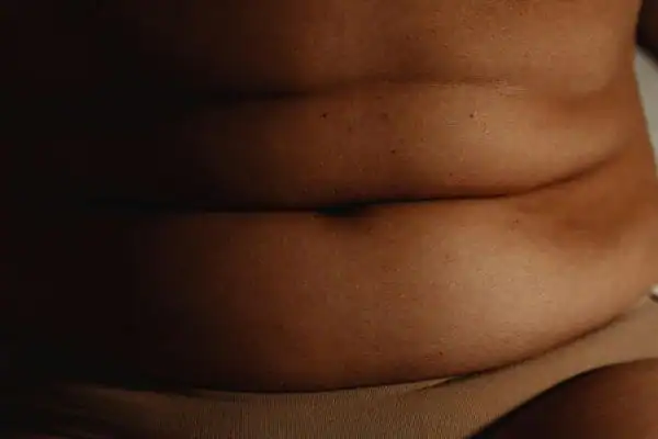 The Hidden Connection: How Stress Shapes Your Fitness and Body Composition 3 image of what stress can do on the stomach area and how Lipo 360 Belper can help to change your body shape.